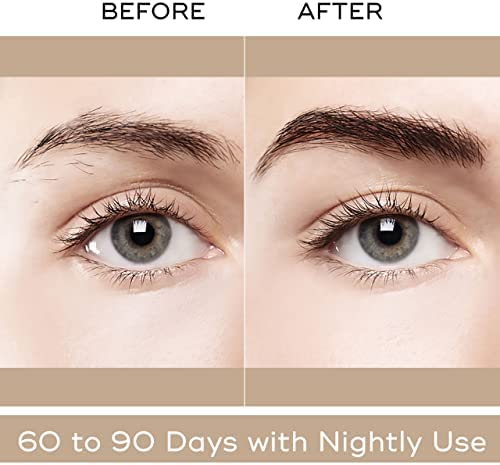 Minoxidil Kirkland Espuma