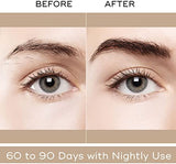 Minoxidil Kirkland Espuma